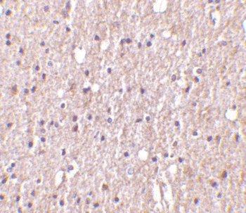 Image: Immunohistochemistry of TWEAK in human brain tissue (Photo courtesy of Sigma-Aldrich Inc.).